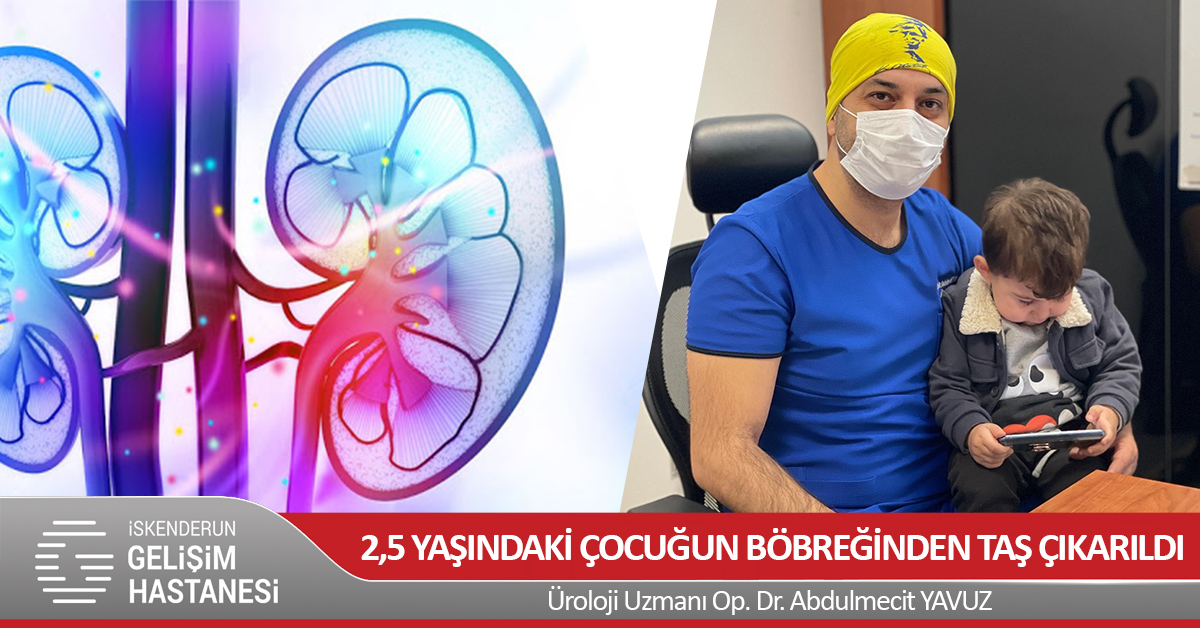 2,5 YAŞINDAKİ ÇOCUĞUN BÖBREĞİNDEN TAŞ ÇIKARILDI