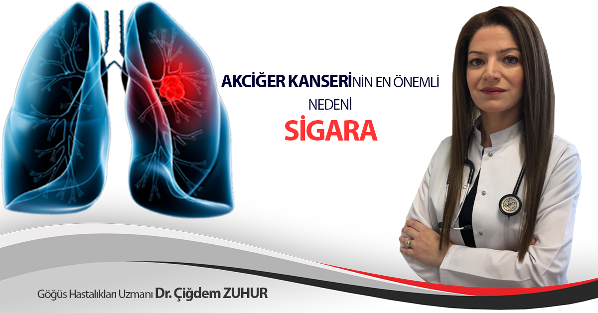 AKCİĞER KANSERİNİN EN ÖNEMLİ NEDENİ “SİGARA”