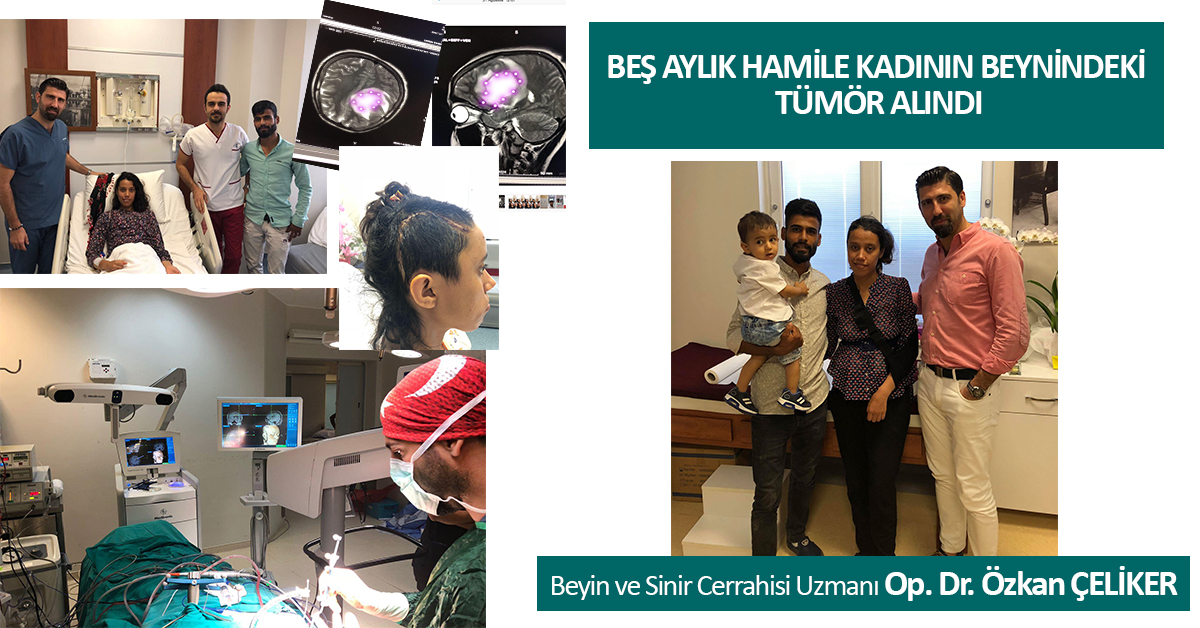  BEŞ AYLIK HAMİLE KADININ BEYNİNDEKİ TÜMÖR ALINDI