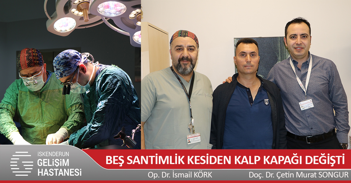 BEŞ SANTİMLİK KESİDEN KALP KAPAĞI DEĞİŞTİ