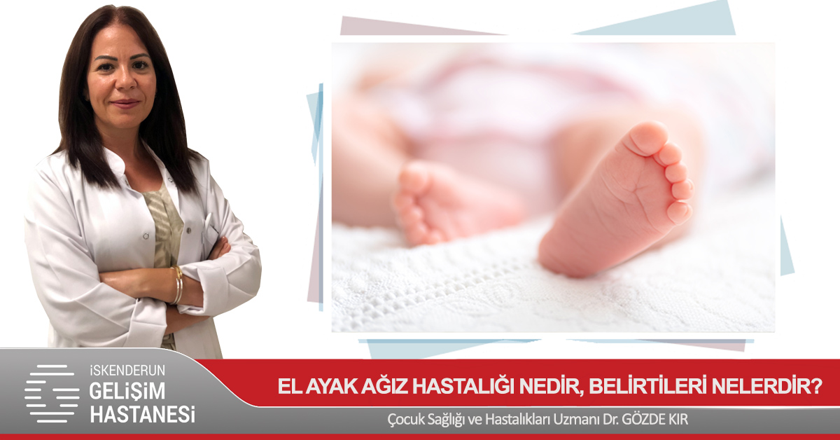 ÇOCUKLARDA ‘EL AYAK AĞIZ’ HASTALIĞINA DİKKAT!