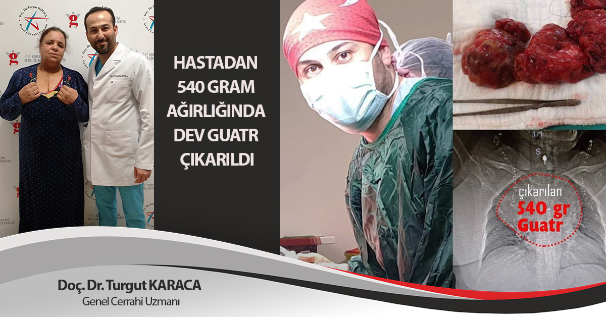 HASTADAN 540 GRAM AĞIRLIĞINDA DEV GUATR ÇIKARILDI