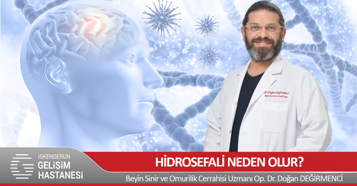 HİDROSEFALİ NEDEN OLUR?