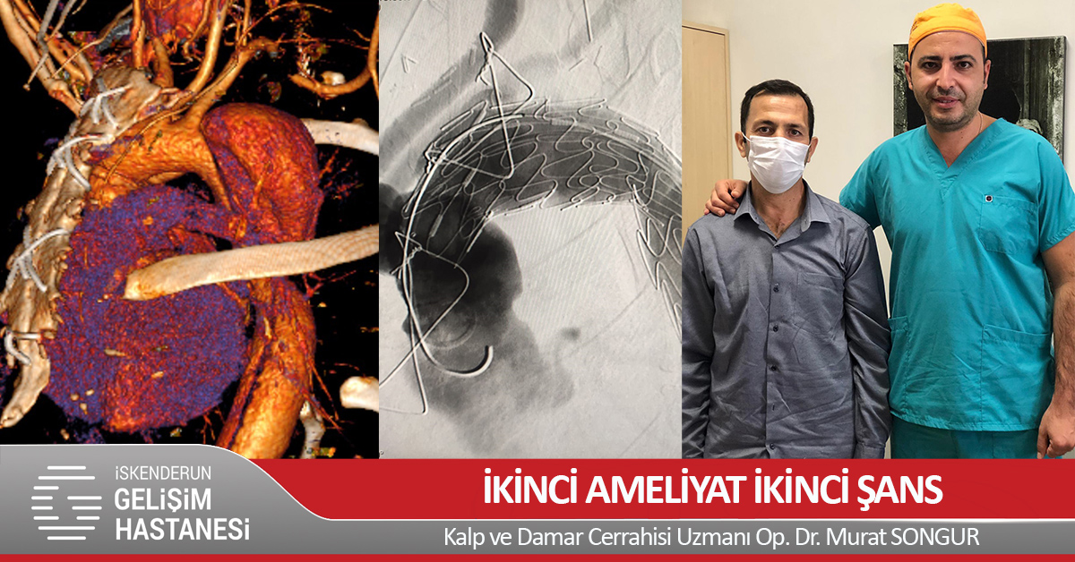 İKİNCİ AMELİYAT İKİNCİ ŞANS