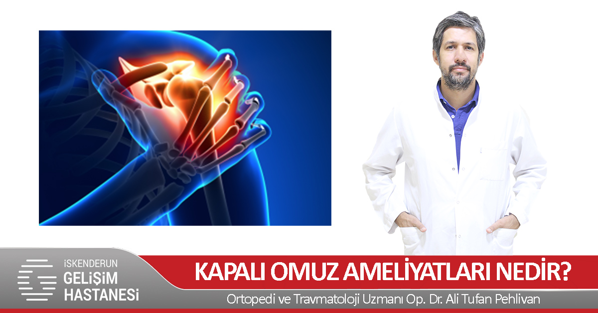 KAPALI OMUZ AMELİYATLARI NEDİR?