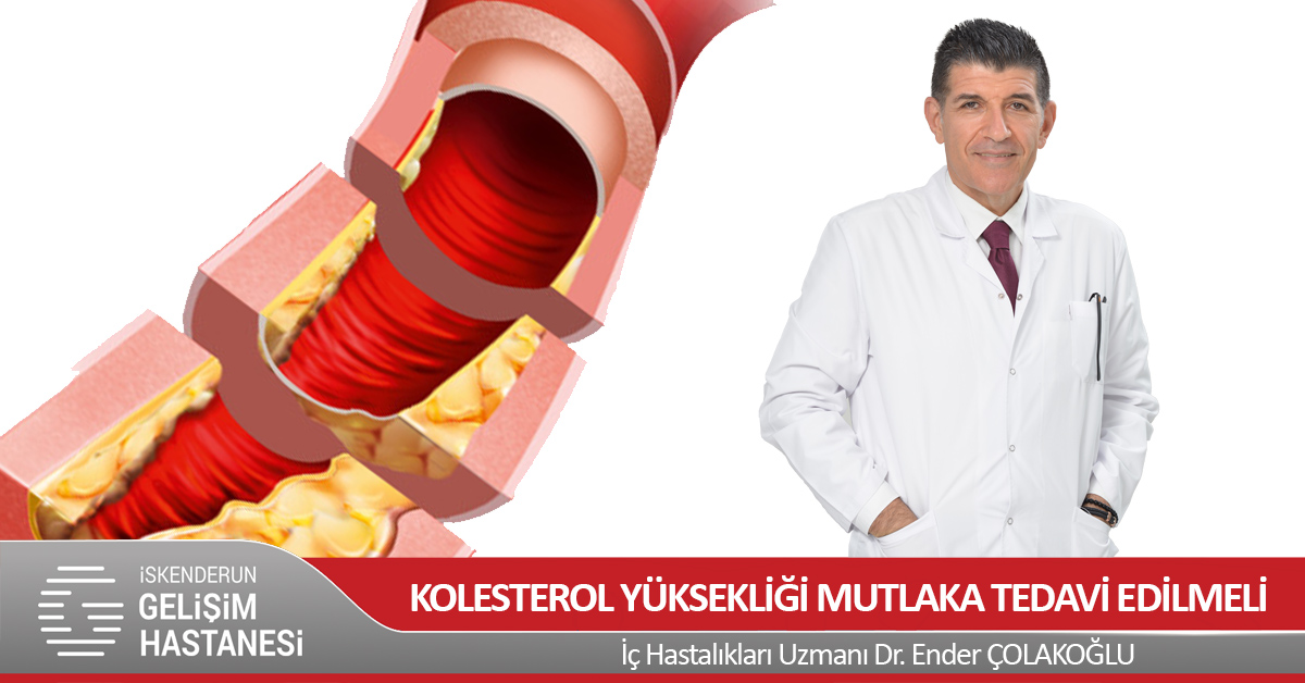 KOLESTEROL YÜKSEKLİĞİ MUTLAKA TEDAVİ EDİLMELİ