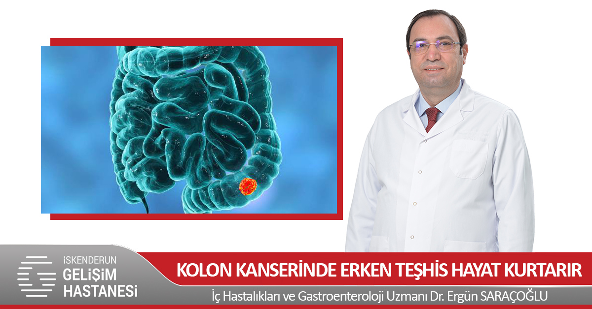 KOLON KANSERİNDE ERKEN TEŞHİS HAYAT KURTARIR