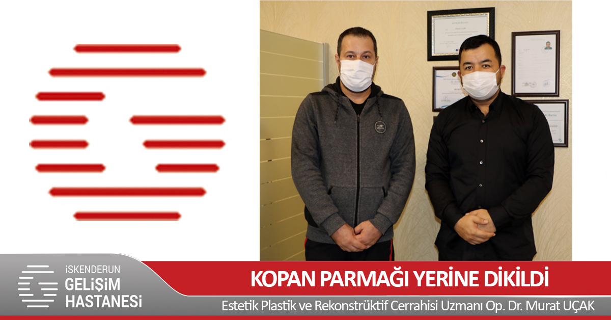  KOPAN PARMAĞI YERİNE DİKİLDİ