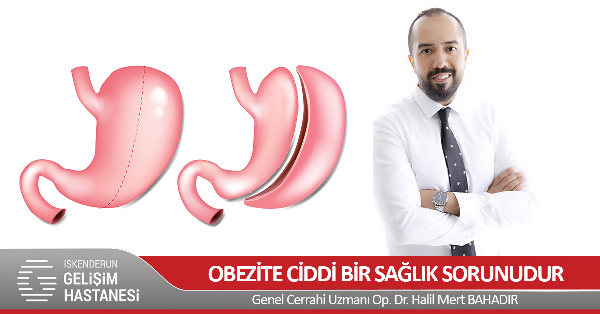 OBEZİTE CİDDİ BİR SAĞLIK SORUNUDUR