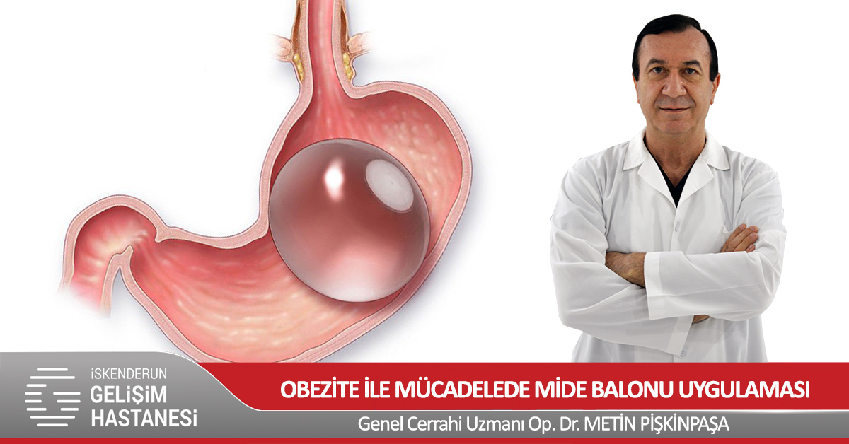 OBEZİTE İLE MÜCADELEDE MİDE BALONU UYGULAMASI