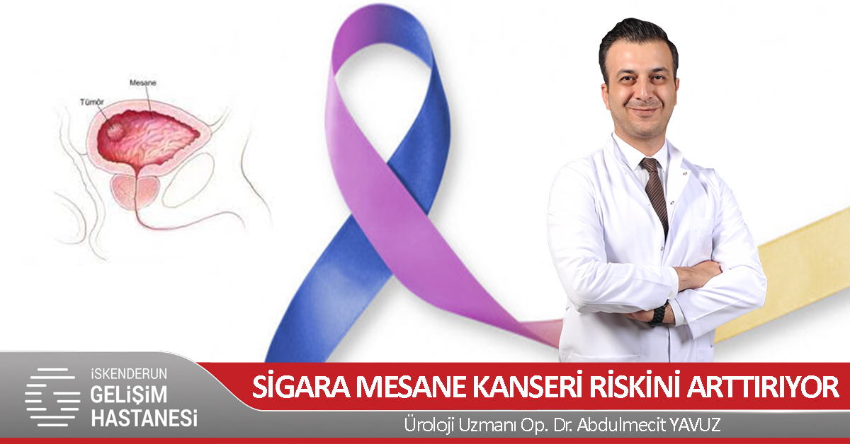 SİGARA MESANE KANSERİ RİSKİNİ ARTTIRIYOR!