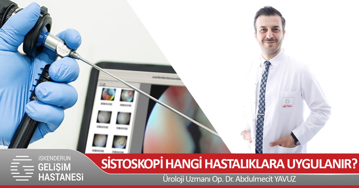 SİSTOSKOPİ HANGİ HASTALIKLARA UYGULANIR?
