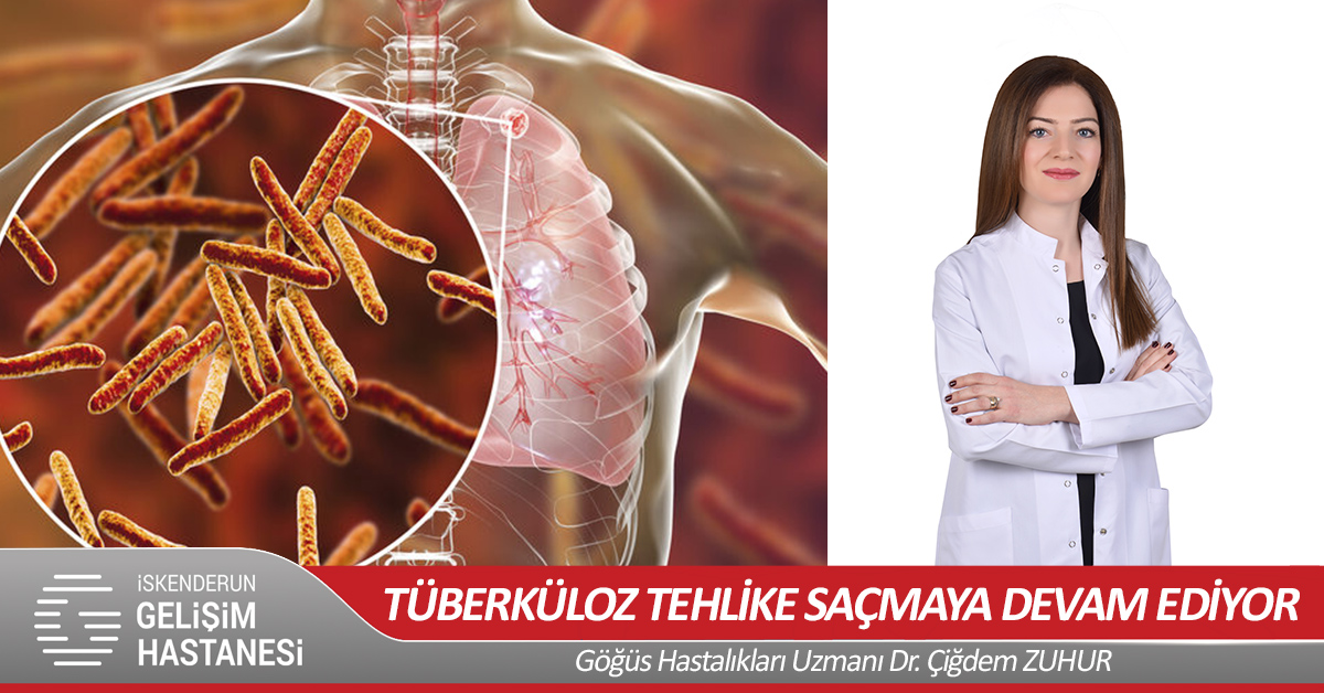  TÜBERKÜLOZ TEHLİKE SAÇMAYA DEVAM EDİYOR