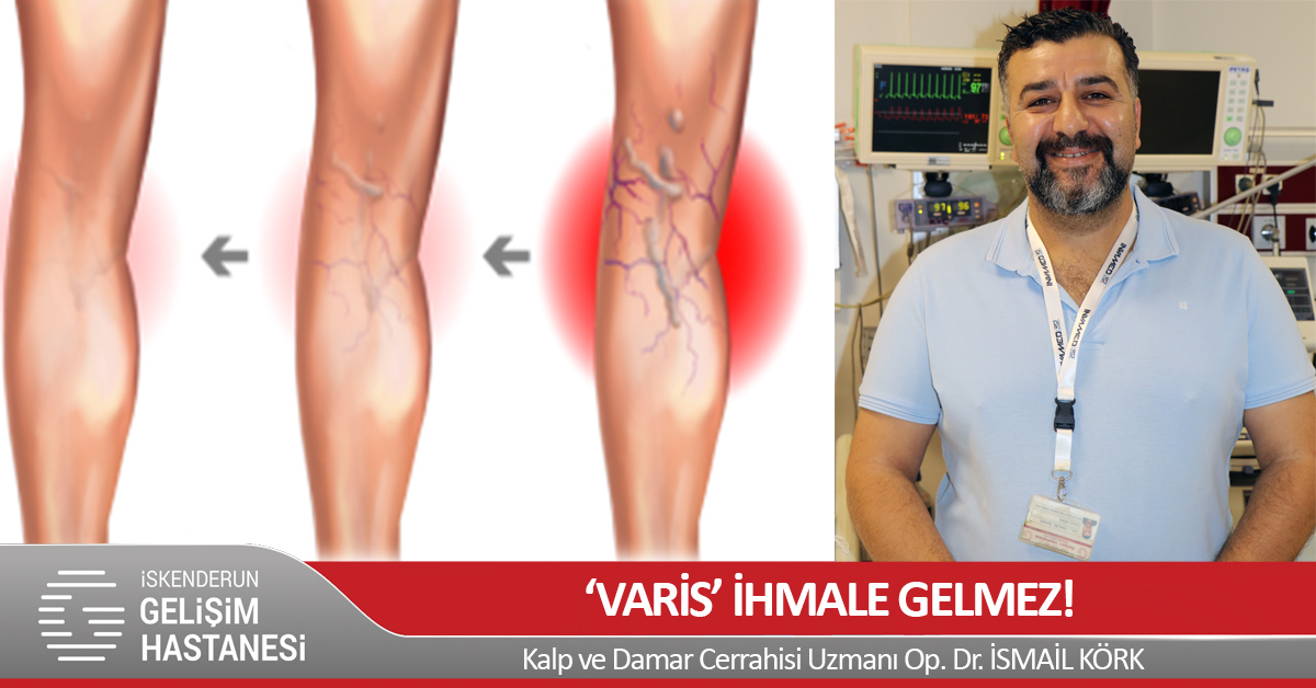 “VARİS” İHMALE GELMEZ!